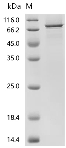 SDS-PAGE