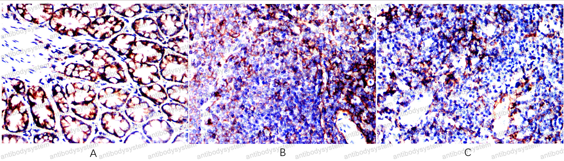 Валидация AntibodySystem RHD14802