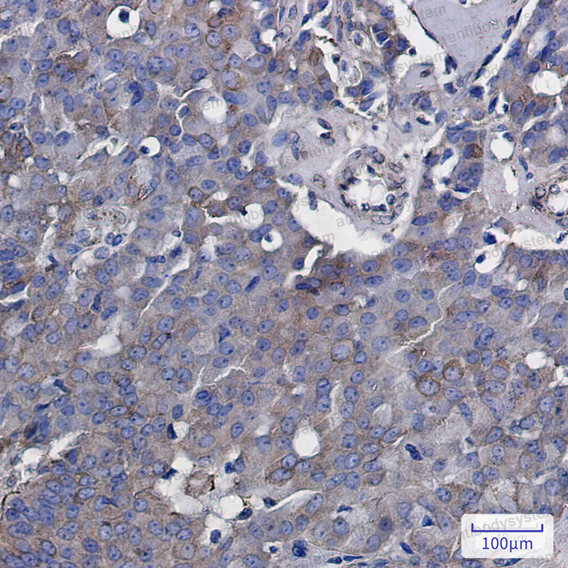 Валидация AntibodySystem RHD39301