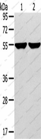 Вестерн-блоттинг, TRIM62, клетки 231 и HepG2