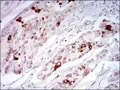 Валидация AntibodySystem RHH12601