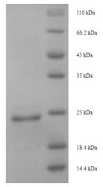 SDS-PAGE