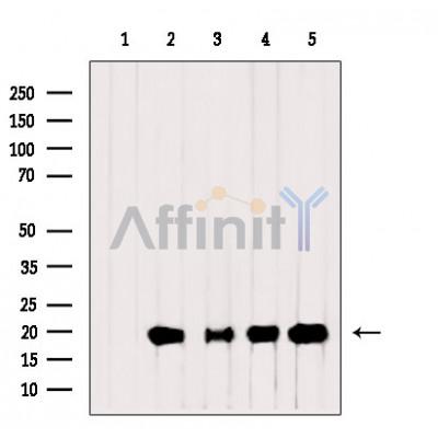 Валидация Affinity DF3705 - 14742