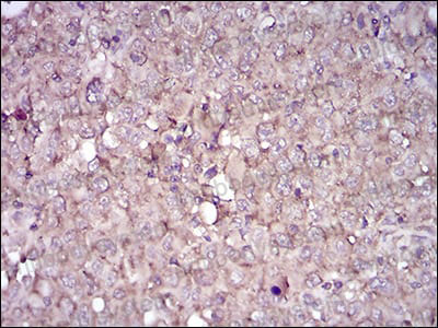 Валидация AntibodySystem RHD80808