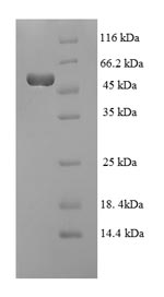 SDS-PAGE