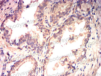 Валидация AntibodySystem RHF15802