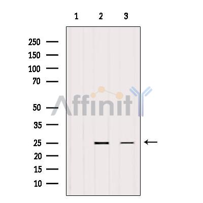 Валидация Affinity AF6110 - 3321