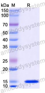Валидация SDS-PAGE - AntibodySystem RCK81008