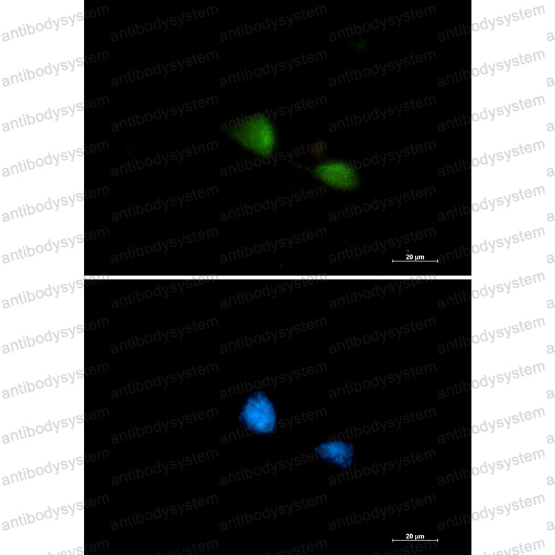 Валидация IF - AntibodySystem RHJ37103