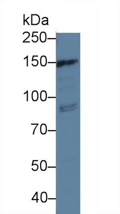 13989