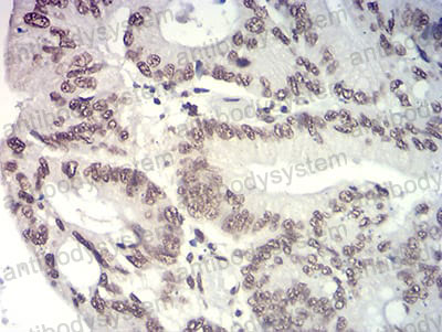 Валидация AntibodySystem RHE91303