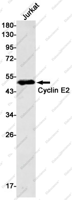Вестерн-блоттинг, Cyclin E2, клетки Jurkat