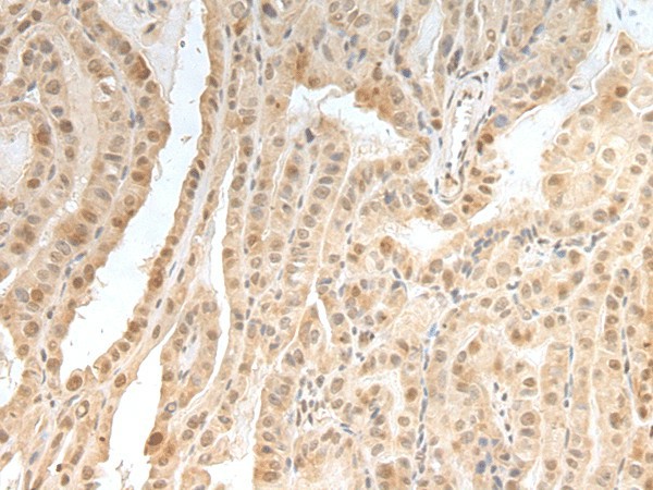 Валидация Elabscience E-AB-18455