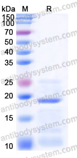 AHJ36103, SDS-PAGE