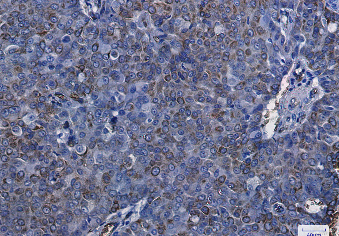 Валидация AntibodySystem RHD85601