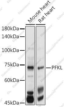 Вестерн-блоттинг, PFKL, различные клеточные линии