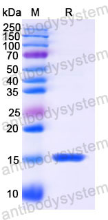 Валидация SDS-PAGE - AntibodySystem RHJ90201