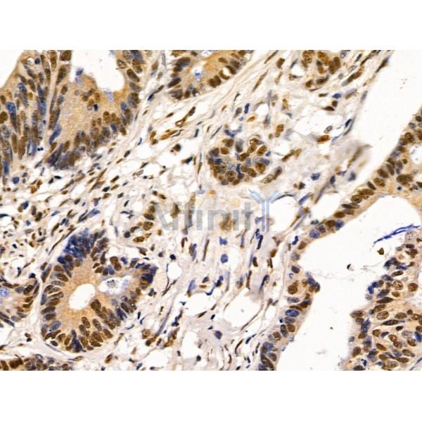 Валидация Affinity AF5475 - 3144