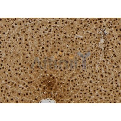 Валидация Affinity DF6150 - 17386