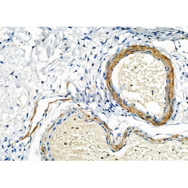 Валидация Affinity DF6420 - 17790