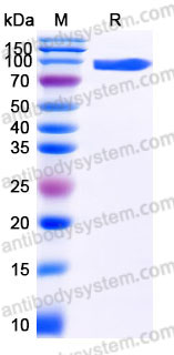 EHD23601, SDS-PAGE