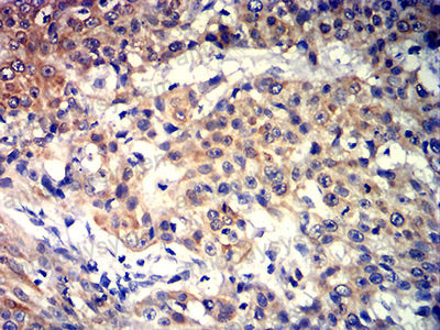 Валидация AntibodySystem RHC99304