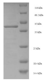 SDS-PAGE
