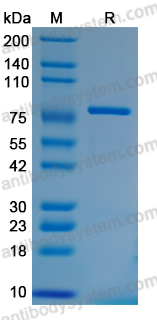 AHJ36602, SDS-PAGE