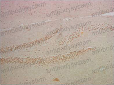 Валидация AntibodySystem RHG01006 (2784)