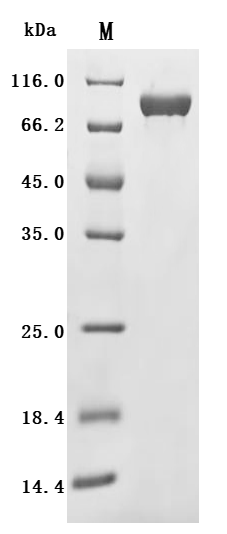 SDS-PAGE
