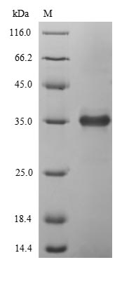 SDS-PAGE