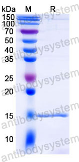 Валидация SDS-PAGE - AntibodySystem RHB05701
