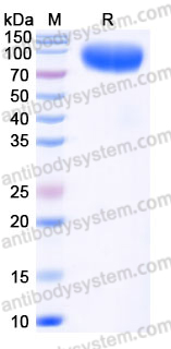 AHK27205, SDS-PAGE