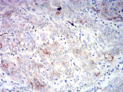 Валидация AntibodySystem RHD00202