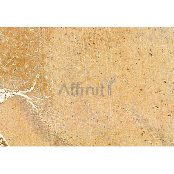 Валидация Affinity DF12010 - 6014