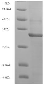SDS-PAGE