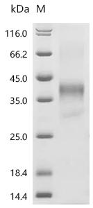 SDS-PAGE