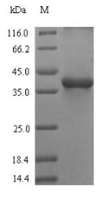SDS-PAGE