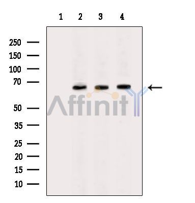 Валидация Affinity DF6661 - 18141