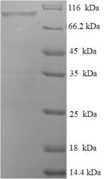SDS-PAGE