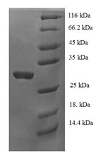 SDS-PAGE
