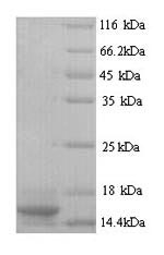 SDS-PAGE