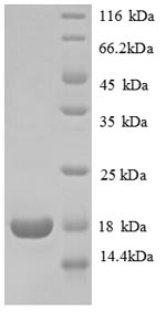 SDS-PAGE