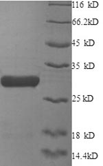 SDS-PAGE