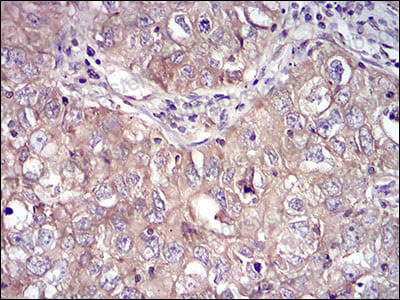 Валидация AntibodySystem RHH07104