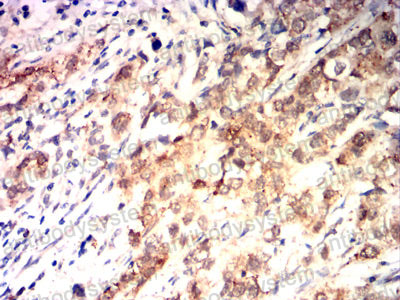 Валидация AntibodySystem RHD31503 (1473)