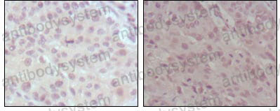 Валидация AntibodySystem RHF98201