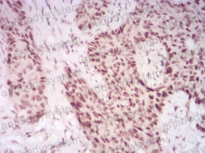 Валидация AntibodySystem RHG90002 (3108)