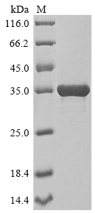 SDS-PAGE