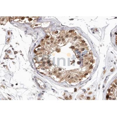 Валидация Affinity AF5202 - 2654